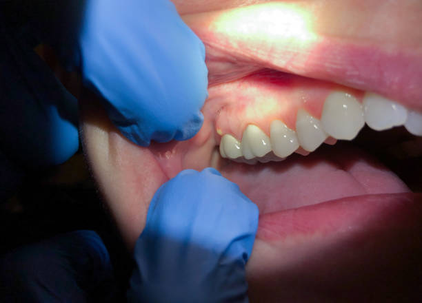 Best Weekend Emergency Dentist in Lake Marcel Stillter, WA